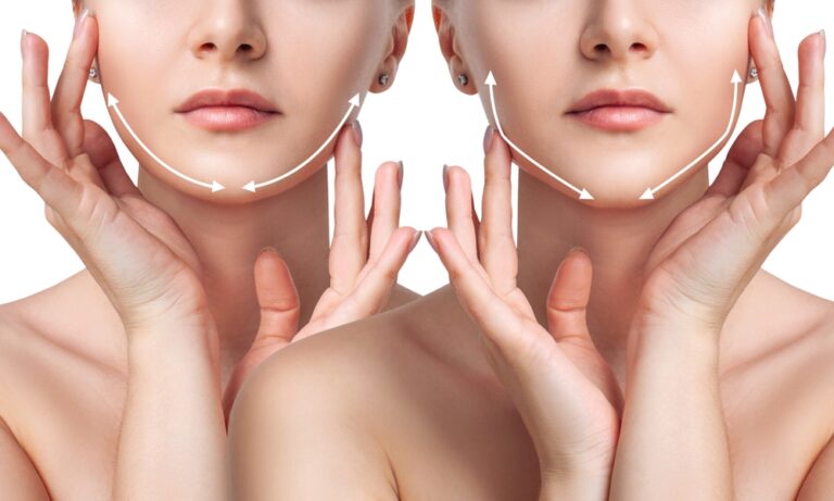 woman,before,and,after,cheekbones,shape,correction.